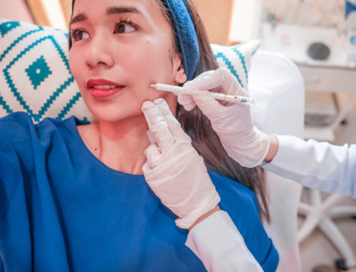 I Fixed My Jaw Problem with Botox!